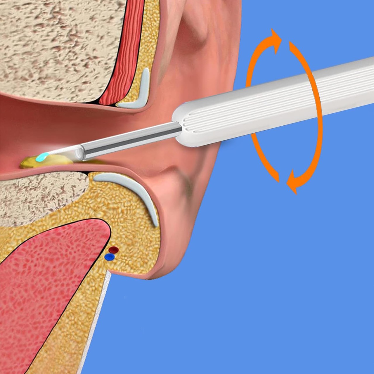 EarStick, pripomoček za čiščenje ušesnega masla s kamero - Image 2
